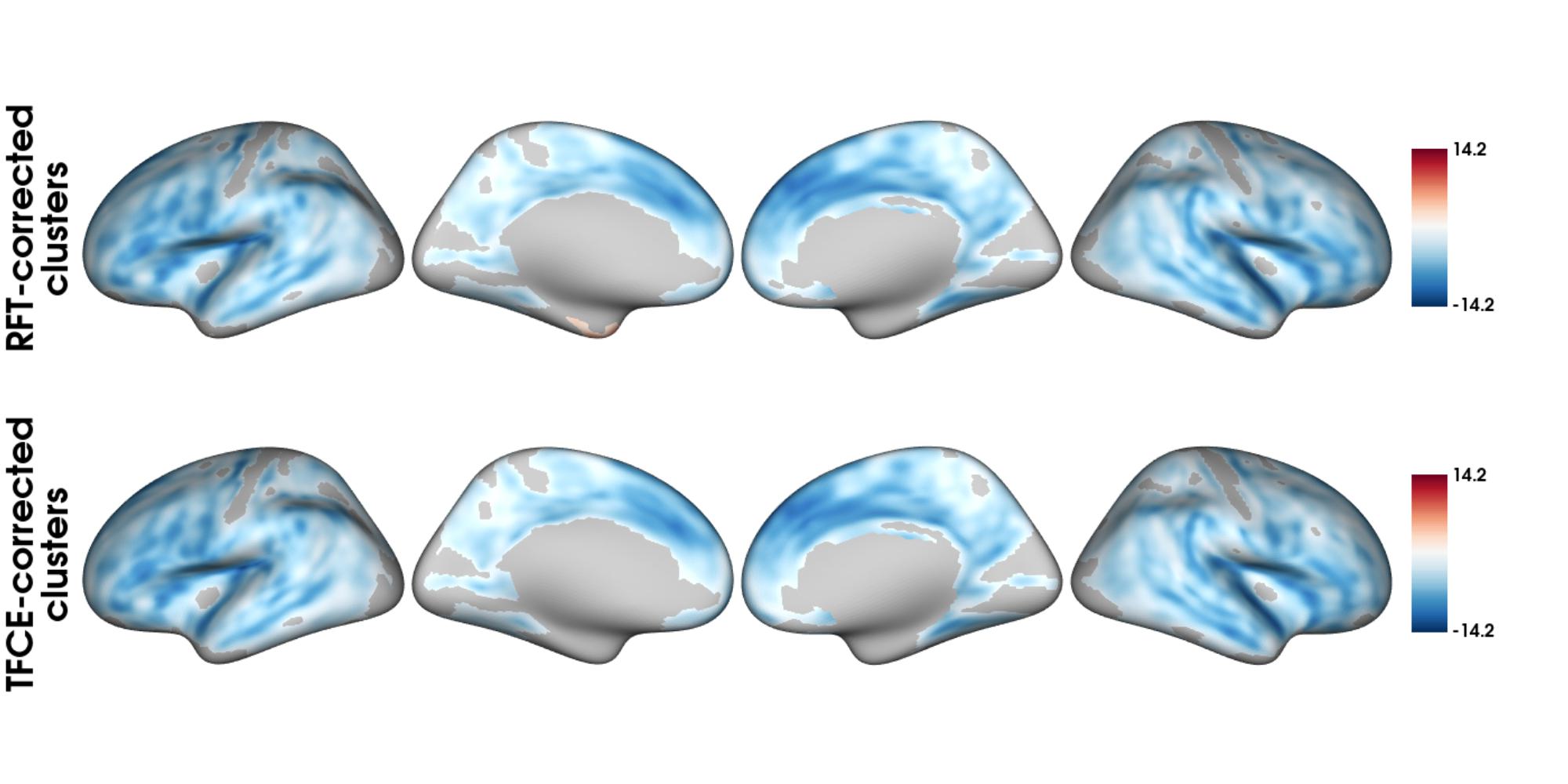 Significant clusters after RFT correction and TFCE correction