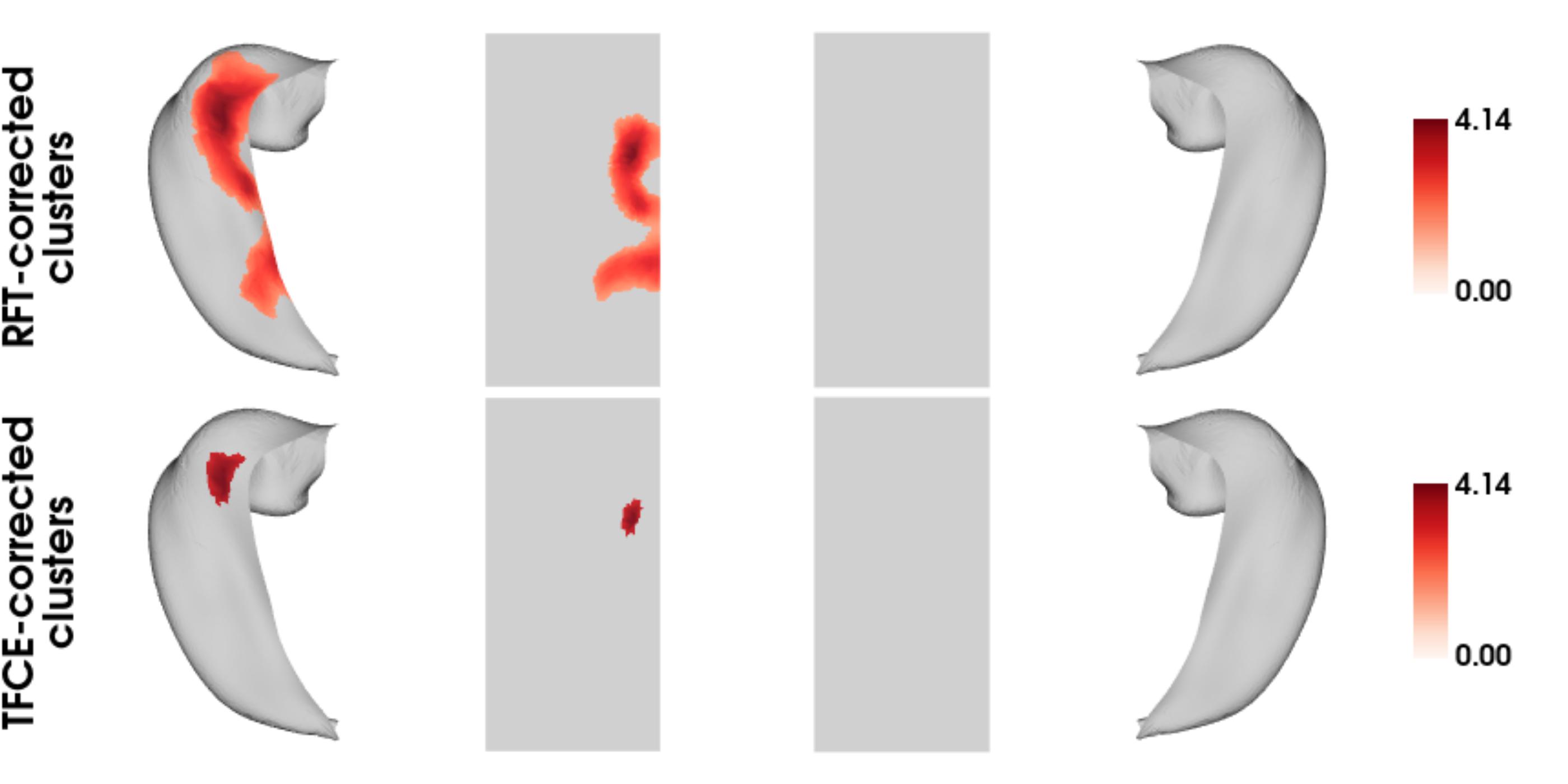 Significant hippocampal clusters, RFT corrected and TFCE corrected