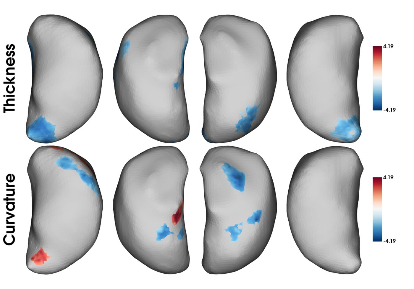 Significant clusters after RFT correction on the thalamus