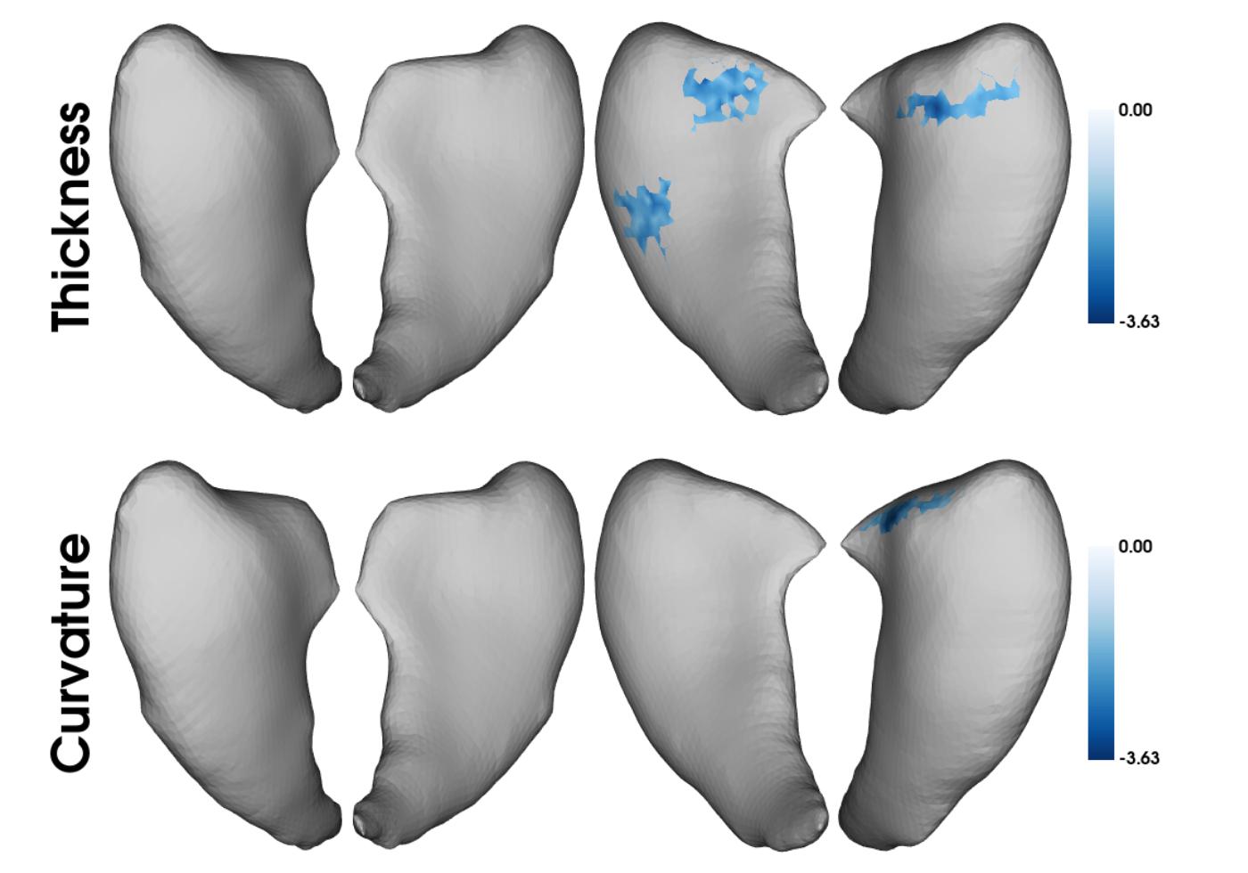 Significant clusters after RFT correction on the caudate nuclei