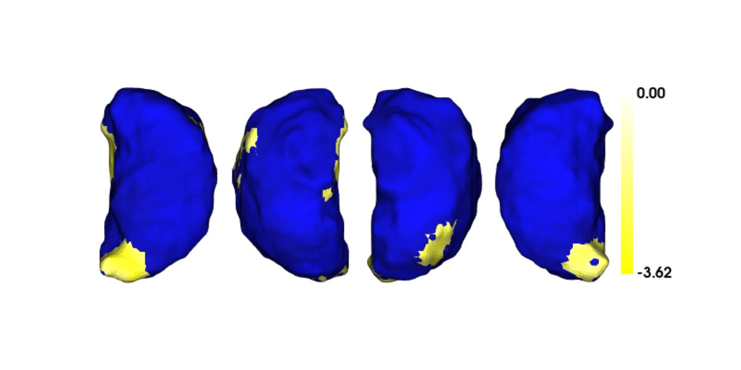 Overlaid thalamic plots