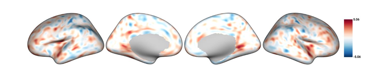 Unthresholded t-statistic map
