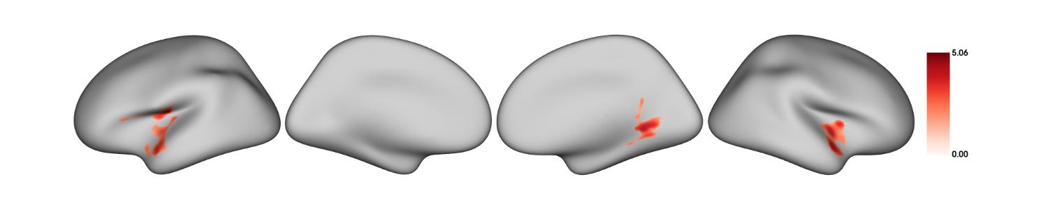 Thresholded t-statistic map