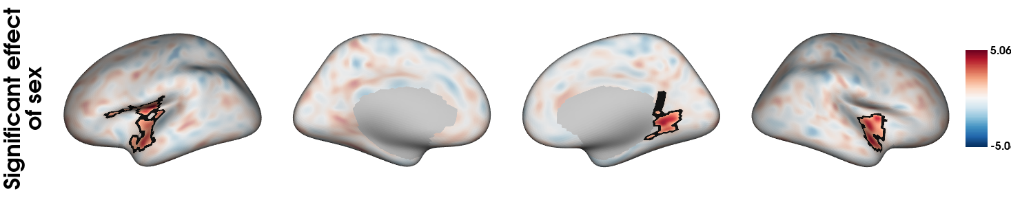 Significant vertices on top of transparent t map