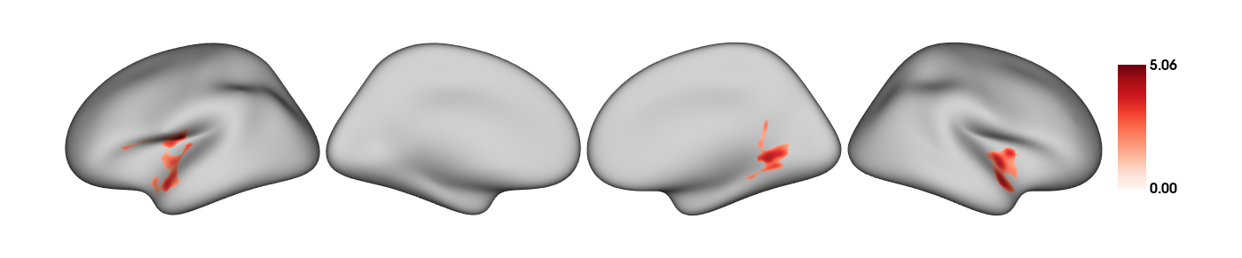 Significant clusters after RFT correction